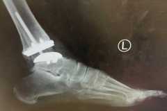 0030IMG-20250827-WA0006