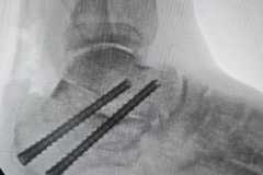 00180IMG-20250827-WA0020